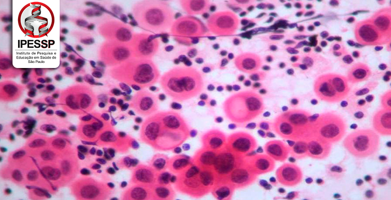 Citologia Hematologica