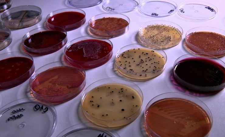 Estudo identifica 23 mil fungos e bactérias em celulares
