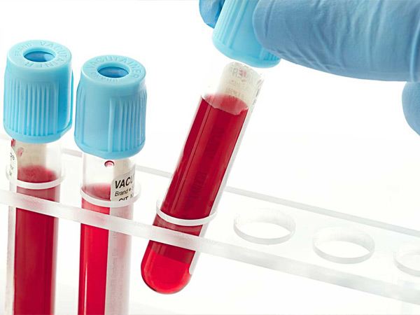 Eficácia de estratégias para rastrear doadores de sangue com variantes de RH em uma população mista