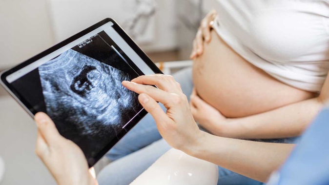 DEFEITOS CONGÊNITOS E DIAGNÓSTICO PRÉ-NATAL - Blog IPESSP DEFEITOS CONGÊNITOS E DIAGNÓSTICO PRÉ-NATAL - Blog IPESSP