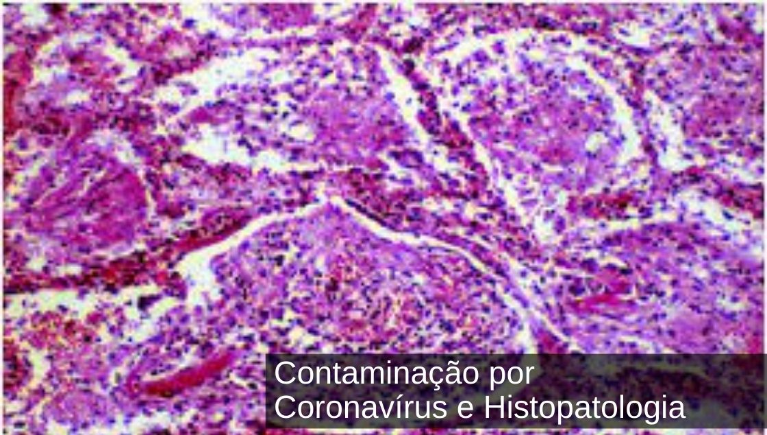 Contaminação por Coronavírus e Histopatologia