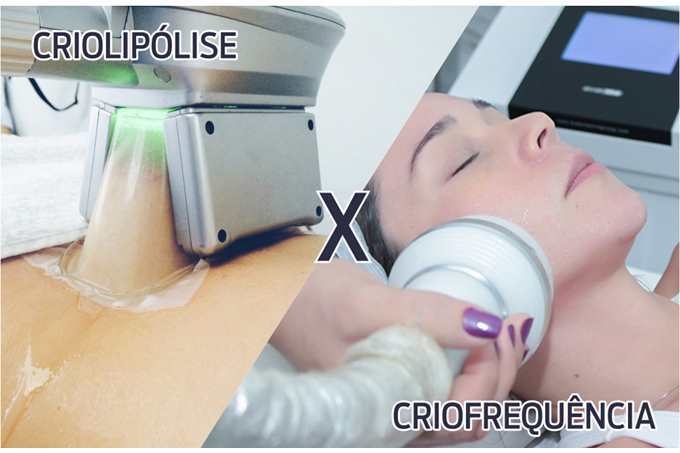 CRIOLIPÓLISE 360° E CRIO FREQUÊNCIA