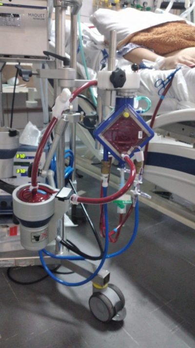 Curso de Atualização – ECMO Básico para Equipe Multidisciplinar